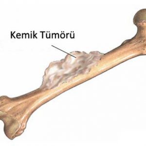 doç-dr-sami-sökücü